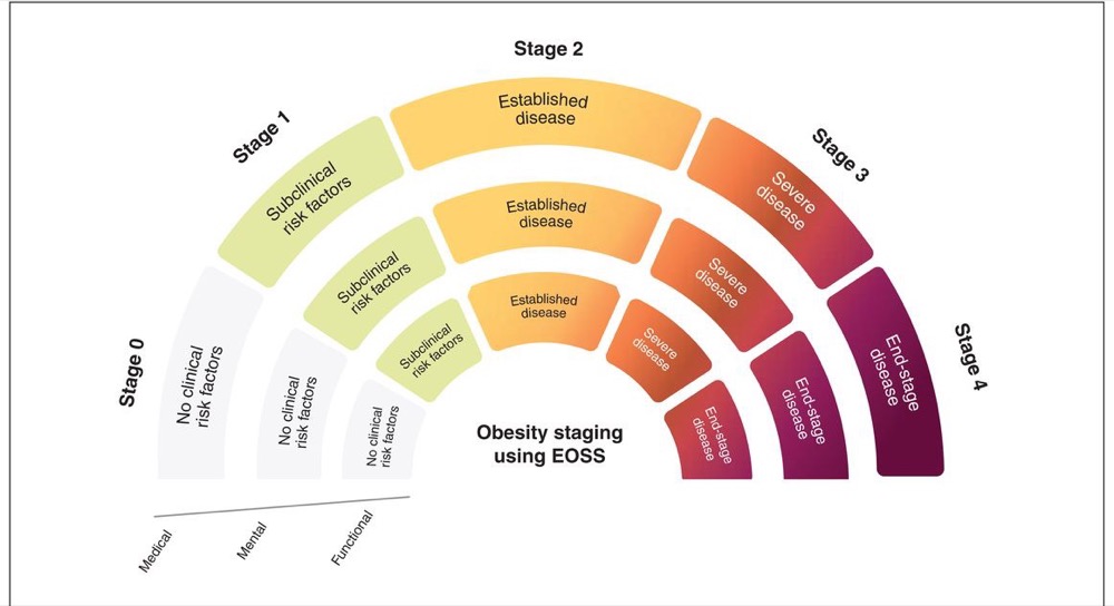 Edmonton Obesity Staging System: Stage 0 (no clinical risk factors) through Stage 4 (end-stage disease), assessed across medical, mental, and functional domains.